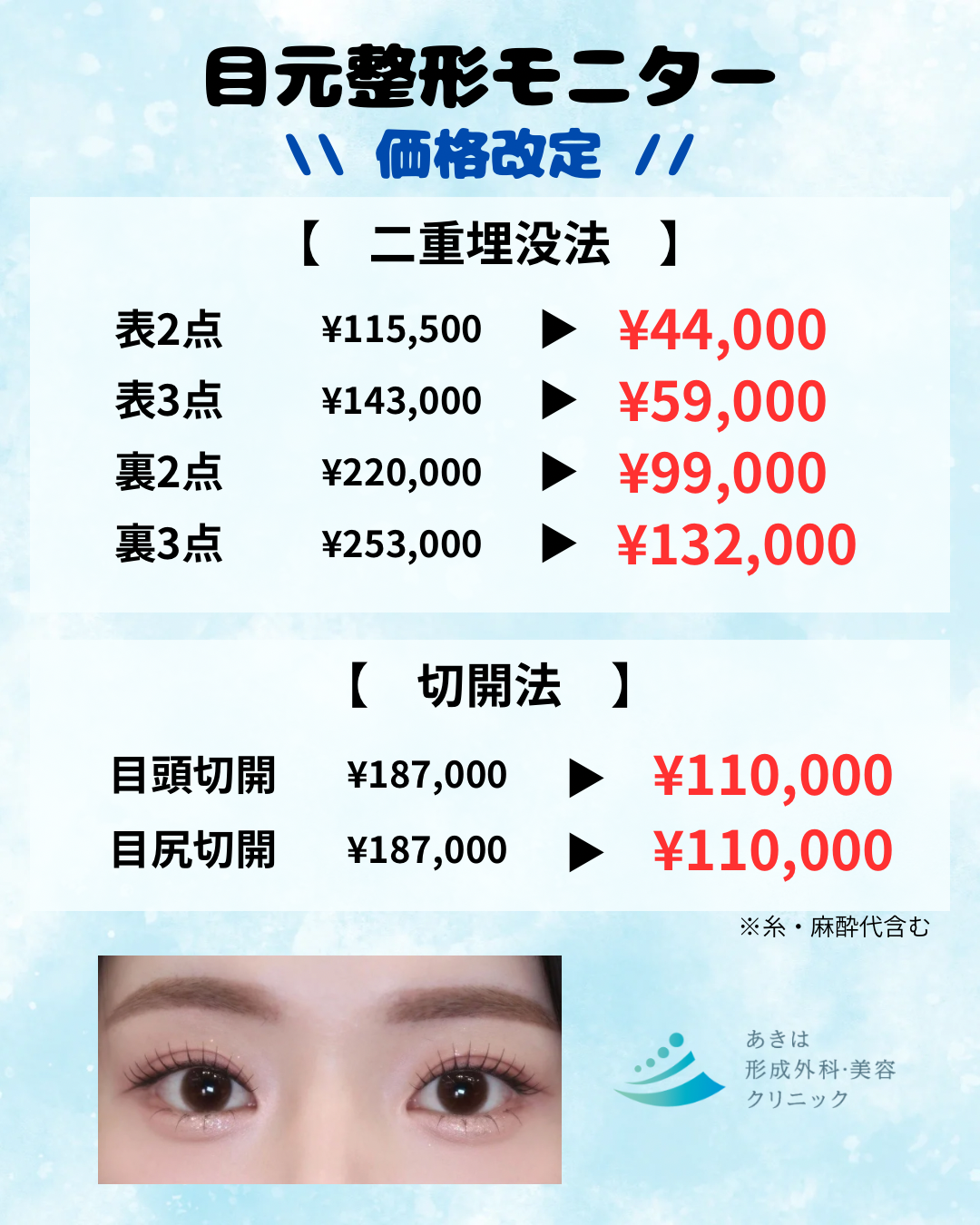 二重埋没法　モニター価格改定👀✨